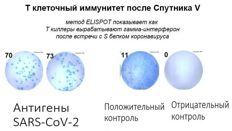 Т-клеточный иммунитет после Спутника V
